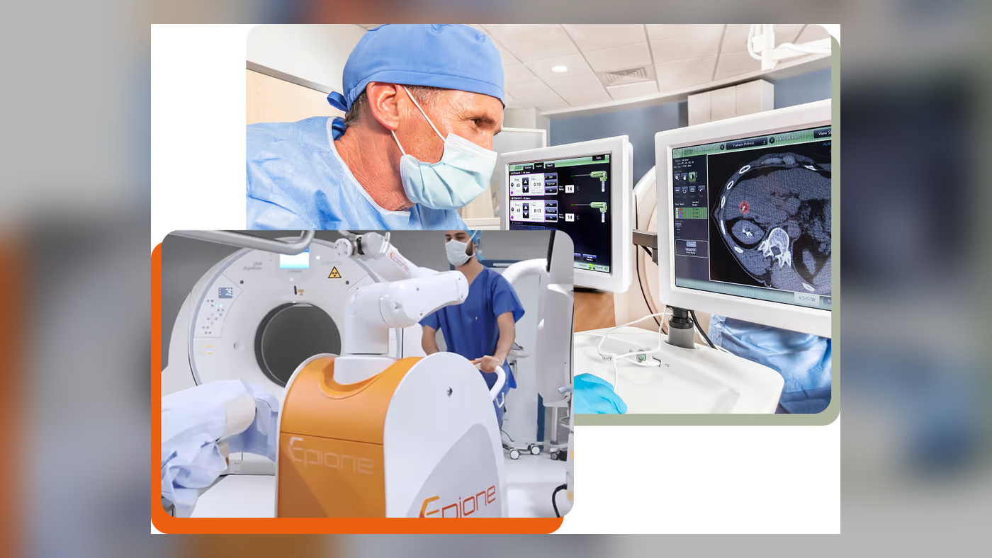 Precision IO uses SRS to show how Epione and NeuWave could become one ablation platform
