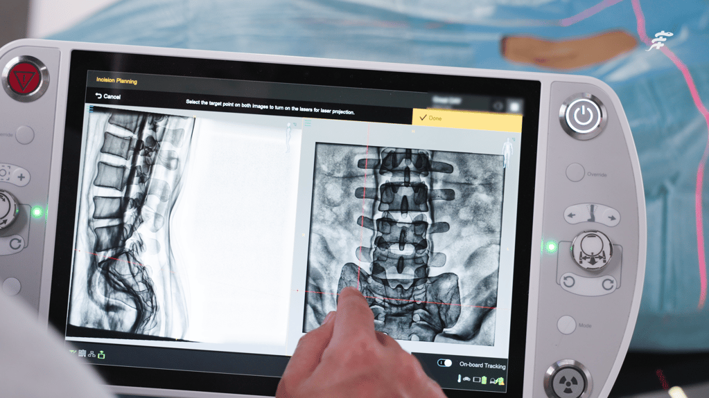 Loop-X® Mobile Imaging Robot