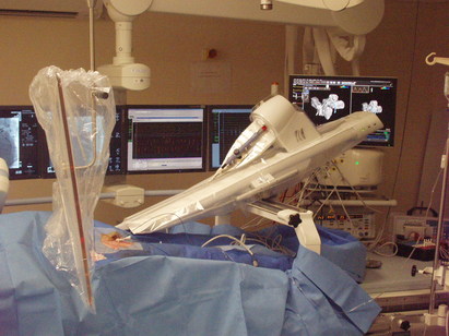 Amigo Remote Catheter System