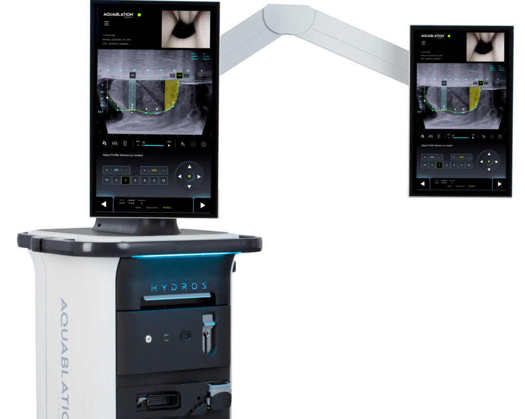 PROCEPT HYDROS console with Aquablation therapy interface