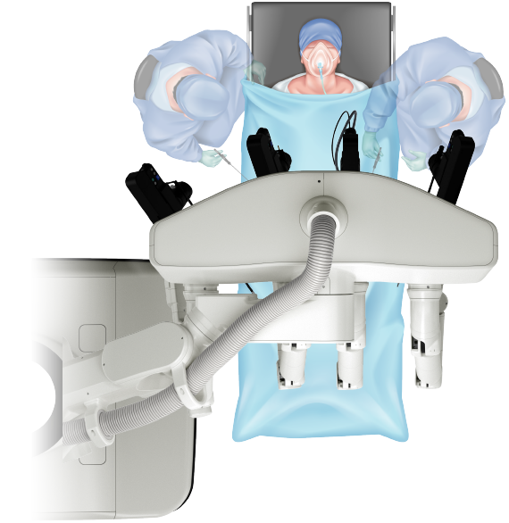 hinotori Surgical Robot System