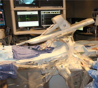 Amigo Remote Catheter System