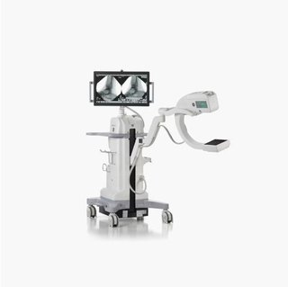 OEC MiniView MAX